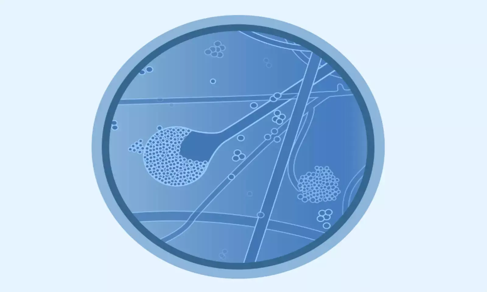 Mucormycosis, Black Fungus Not Same, Dont Use Interchangeably: Docs Mucormycosis, Black Fungus Not Same, Dont Use Interchangeably: Docs