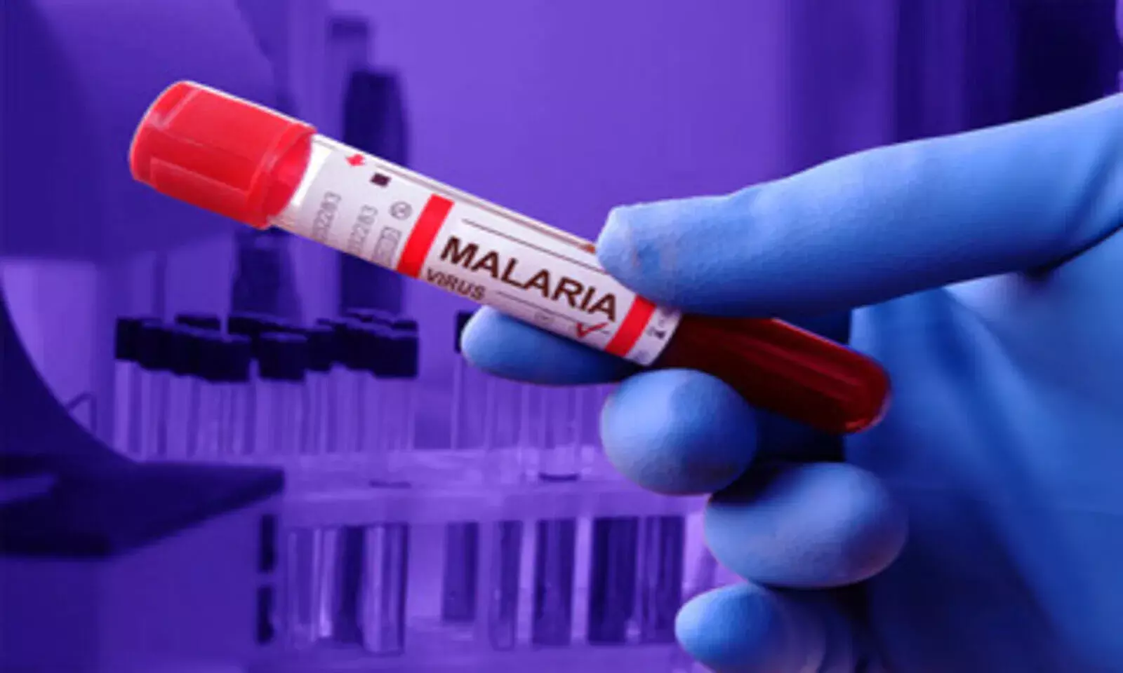 Explained: Why It Took Over 3 Decades To Develop a Vaccine for Malaria? Explained: Why It Took Over 3 Decades To Develop a Vaccine for Malaria?