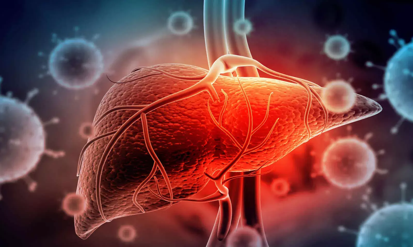 Mystery Hepatitis Strain Outbreak in Children: What We Know So Far Mystery Hepatitis Strain Outbreak in Children: What We Know So Far