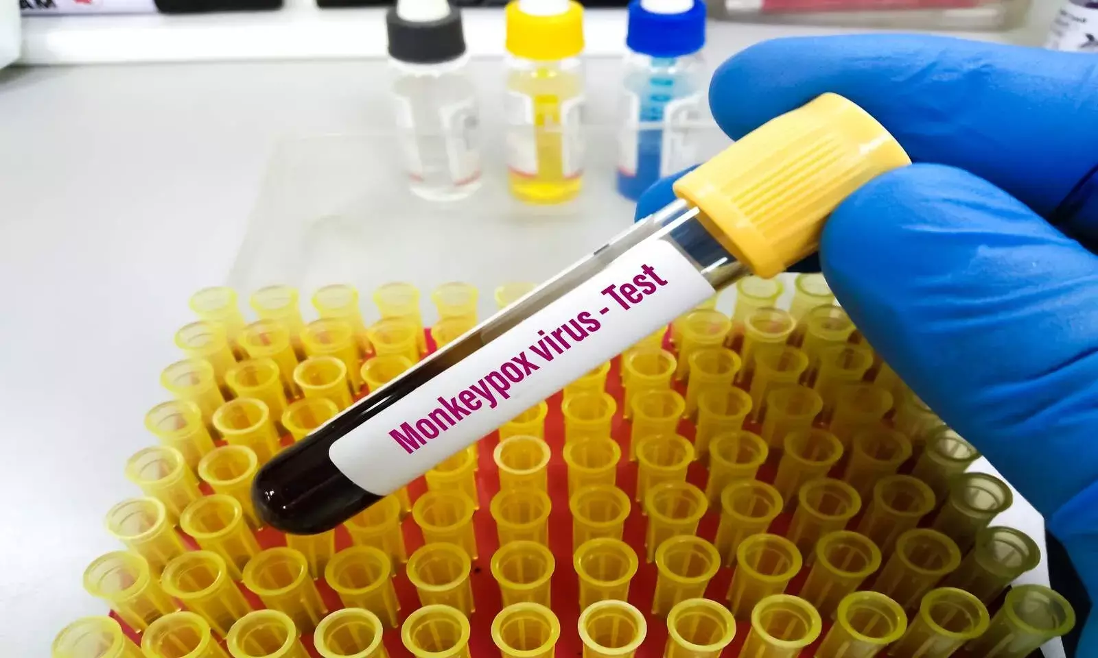 Monkeypox: 5 Myths Around the Virus Debunked Monkeypox: 5 Myths Around the Virus Debunked