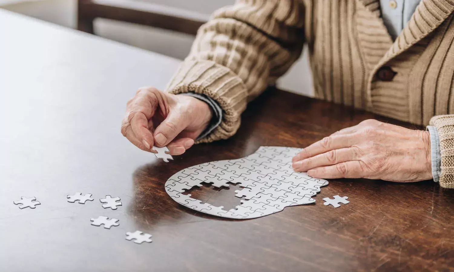 Alzheimers Alzheimers