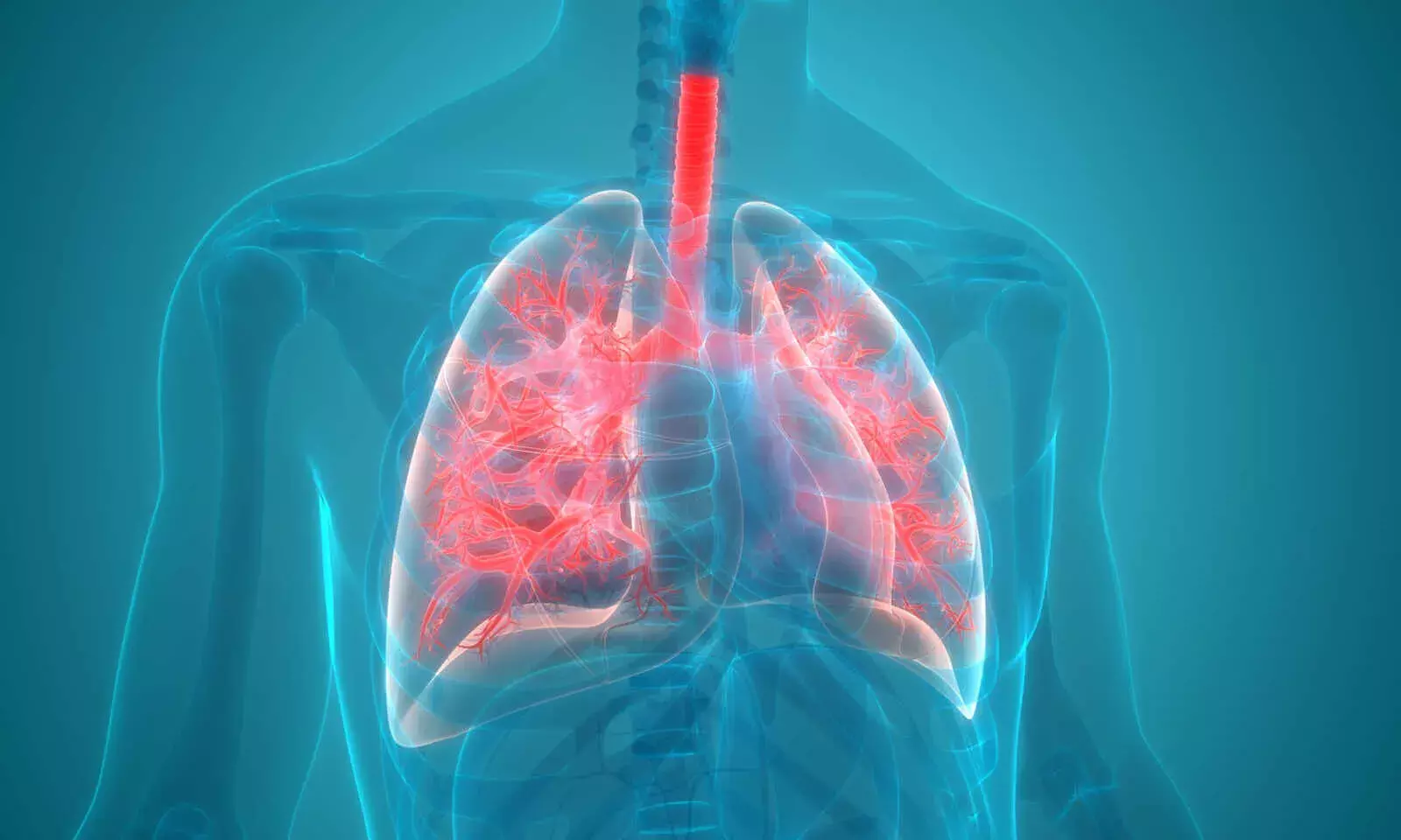 World Pneumonia Day: 7 Myths Around the Disease Debunked World Pneumonia Day: 7 Myths Around the Disease Debunked
