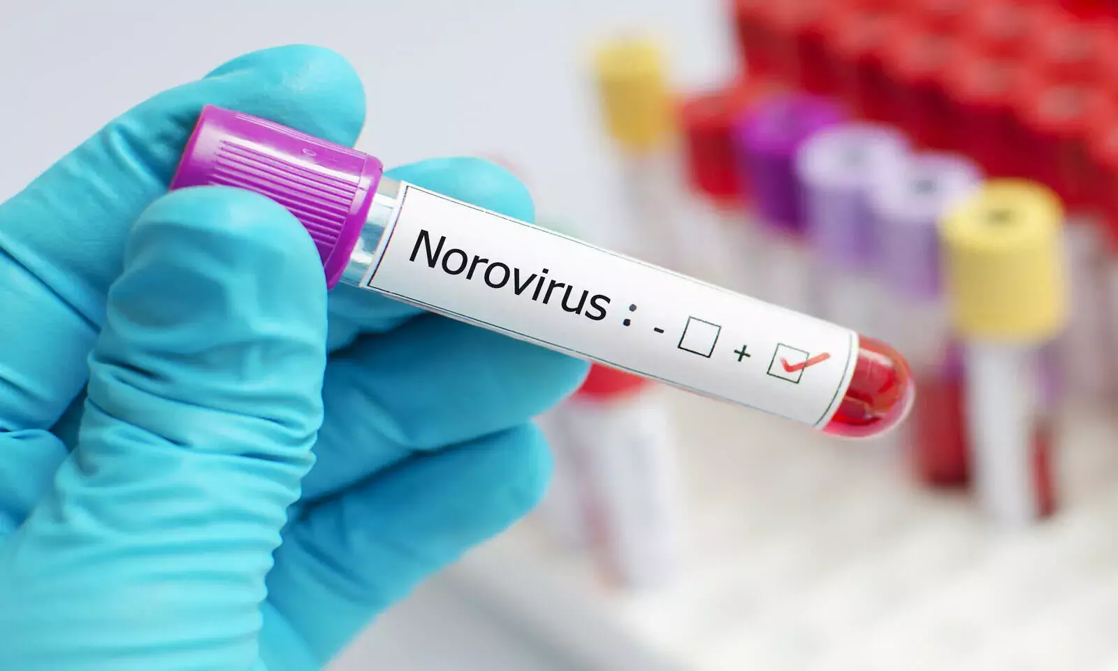 Norovirus: All About the Virus Reported in Kerala